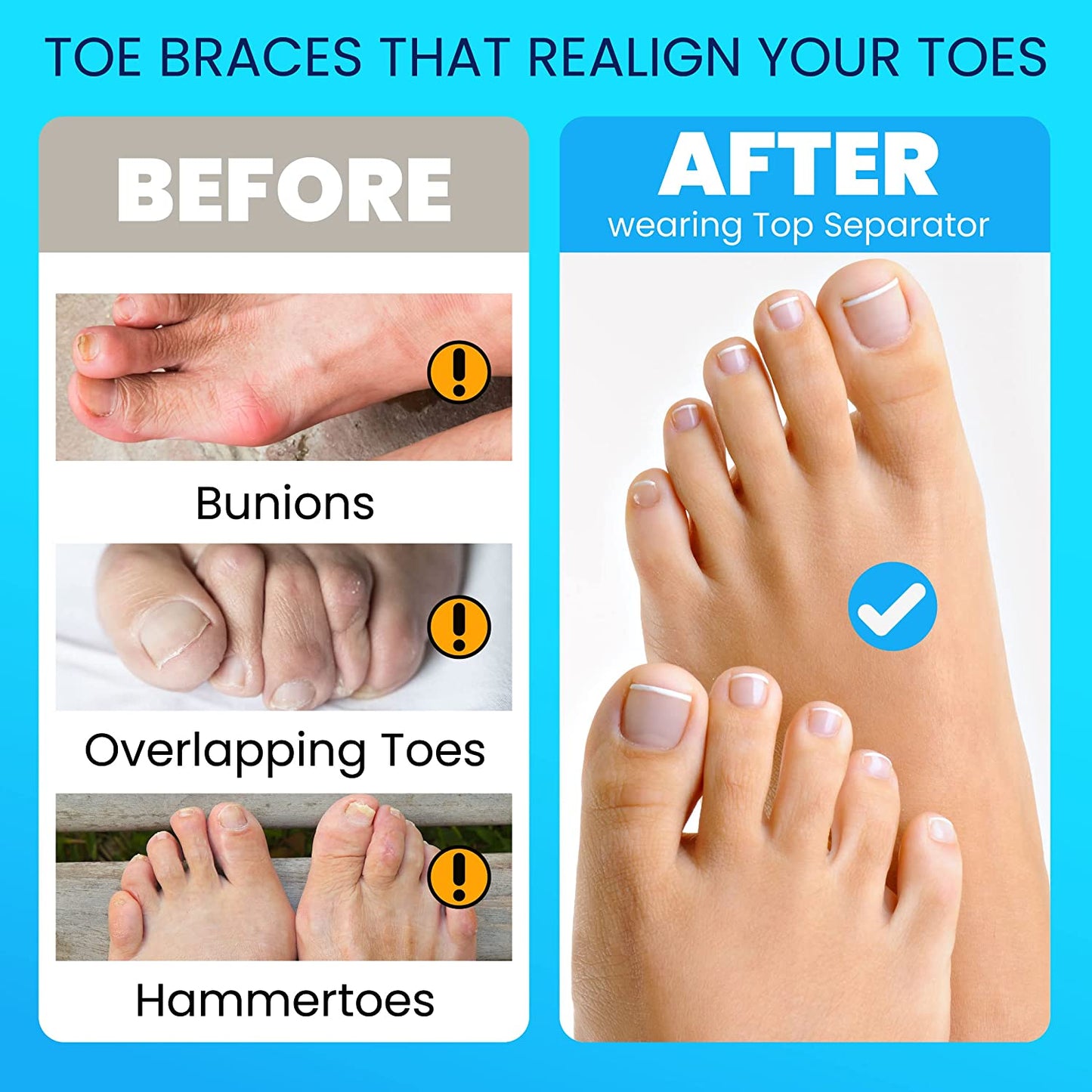 New Toe Separator Toe Spacers for Feet – 2 Pairs Premium Bunion Corrector for Women & Men, Hammer Toe Straightener, Comfortable and Durable Toe Separators for Overlapping Toes